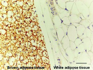 beta lapachone brown fat white fat